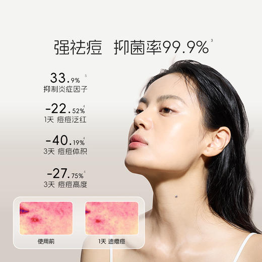 易科美三源光子净肤仪应急祛痘舒缓控油便携 商品图3