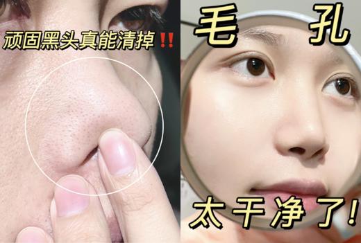 ✨👉🏻皮肤吸收力暴增90%的秘密⚠️大牌院线同款配方👍🏻黑头死皮一扫光！  【颜素真兰花去角质搓泥啫喱】 商品图1