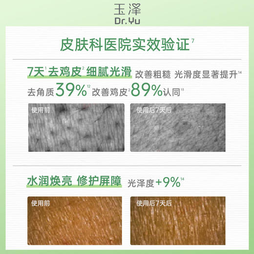 【新品上市】玉泽果酸身体乳去角质祛痘改善粗糙滋润舒缓 商品图5