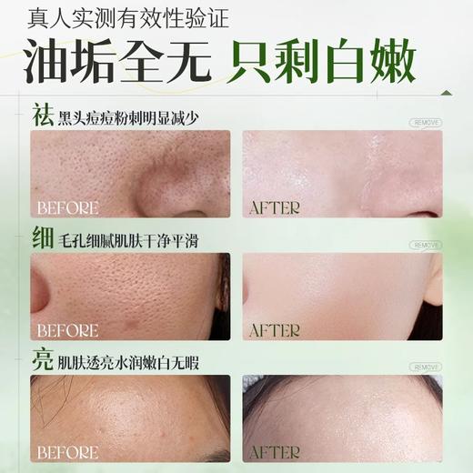 OHBT壬二酸净透控油泥膜棒 商品图3