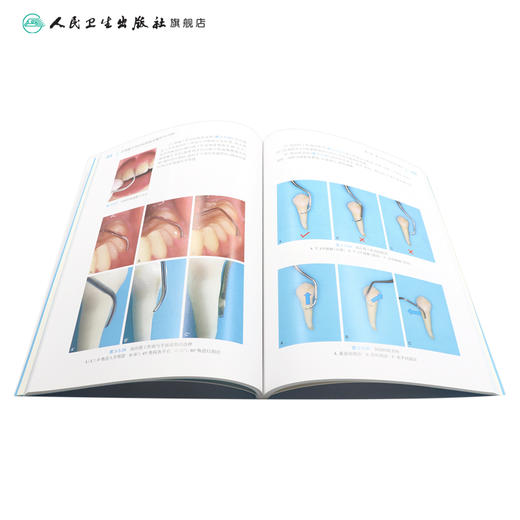 全2册 牙周手术临床操作图谱+牙周龈下刮治和根面平整操作技术图解（口腔临床操作技术丛书）潘亚萍 主编 口腔医学 人民卫生出版社 商品图4