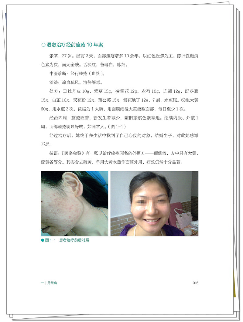 ISBN 978 - 7 - 5132 - 9448 - 5 《马大正中医妇科外治法验案选》也在创想-整本_39_副本.jpg