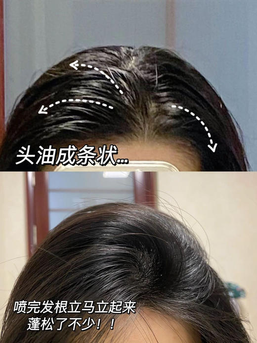 M*EDIBABY蓬松免洗五代止痒控油喷雾 商品图6