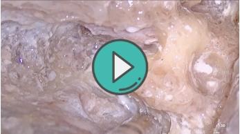 轮廓化半规管3D视频 商品图0