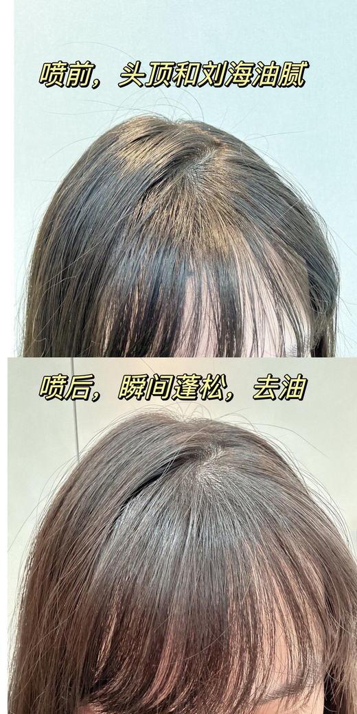 M*EDIBABY蓬松免洗五代止痒控油喷雾 商品图4