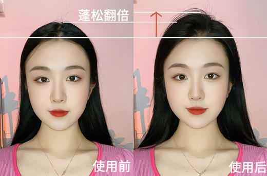 M*EDIBABY蓬松免洗五代止痒控油喷雾 商品图7