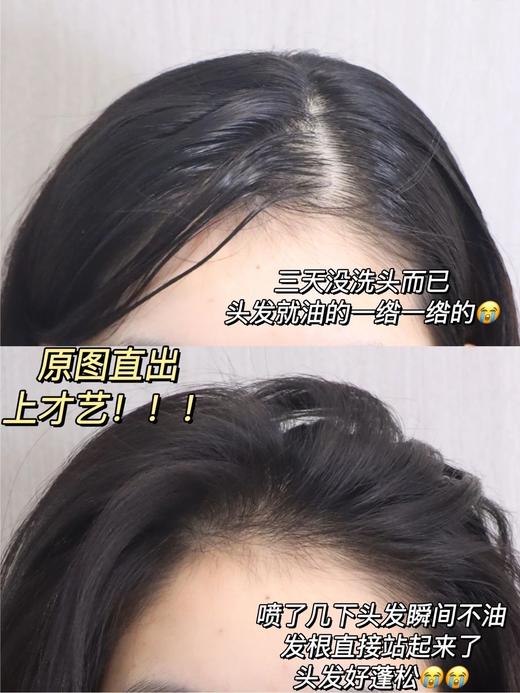 M*EDIBABY蓬松免洗五代止痒控油喷雾 商品图9