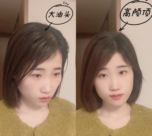 M*EDIBABY蓬松免洗五代止痒控油喷雾 商品图8