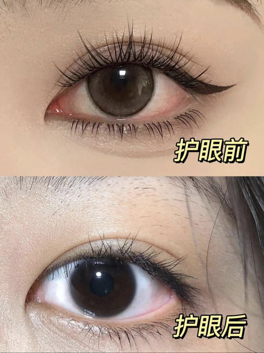 国民老牌 珍视明玻尿酸洗眼液 商品图2