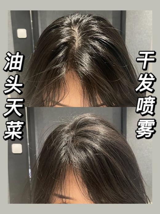 M*EDIBABY蓬松免洗五代止痒控油喷雾 商品图3