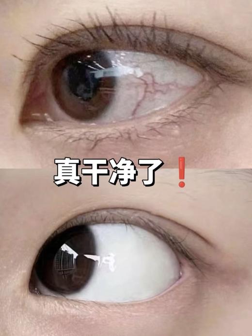 国民老牌 珍视明玻尿酸洗眼液 商品图3