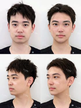 【王雯婷】赫本线重塑