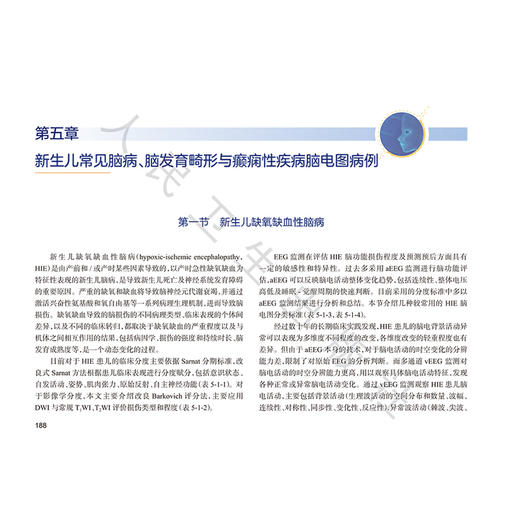 新生儿脑电图图谱 毛健 黄为民 主编 本书详列新生儿连续脑各种常见病所致的脑电图演变的图谱 使之更加系统全面 人民卫生出版社 商品图4