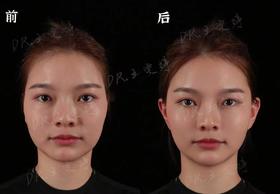 【王雯婷】院长口周年轻化