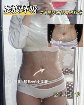 【邓晟华】腰腹环吸案例