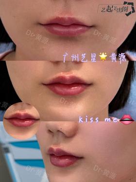 【黄源】主任-嘟嘟唇