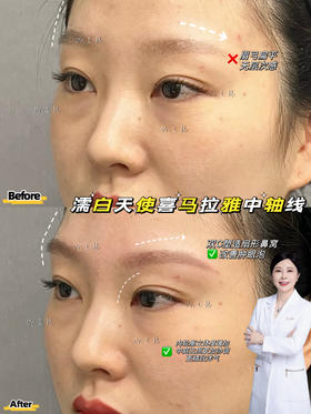 【王艳】院长喜马拉雅中轴线打造