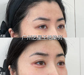 【王艳】弗曼0.5 海魅0.5 卧蚕