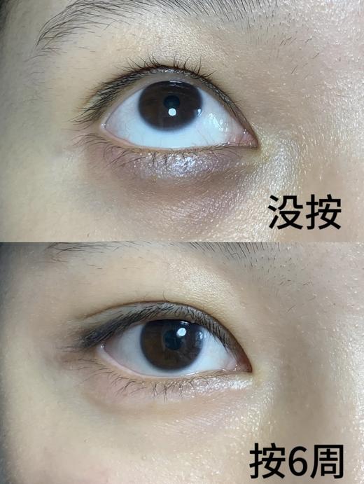 年后发！新增黄铜小青蛙按摩器~一支多用，多部位按摩❗️古法拨筋深度疏通‼️【南美檀木黄铜·小莲蓬拨筋棒】H65黄铜按摩头——促循环 ✅独特莲蓬造型，多触点按摩覆盖全面💆护肤、午休放松、居家美容必备 商品图8