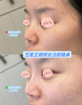 【王艳】院长-注射隆鼻