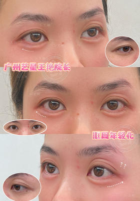 【王艳】院长-恋恋桃花眼打造