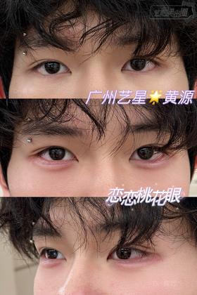 【黄源】主任-眉弓注射