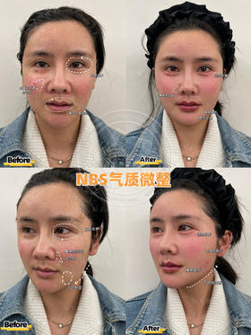 【王艳】院长-NBS气质微整