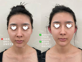 【王雯婷】院长口周年轻化