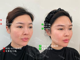 【王雯婷】院长-喜马拉雅中轴线打造