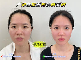 【王艳】院长-外轮廓打造