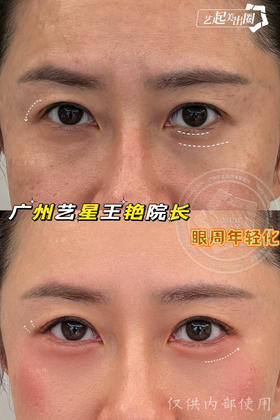 【王艳】院长-眼周年轻化