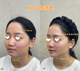 【王雯婷院长】-内外轮廓综合打造