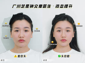 【钟文君】案例-液态提升