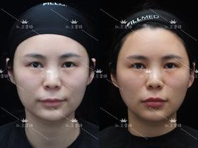 【王雯婷】院长口周年轻化