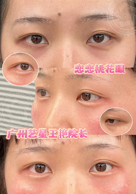 【王艳】院长-恋恋桃花眼