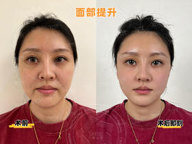 【王艳】院长-面部提升