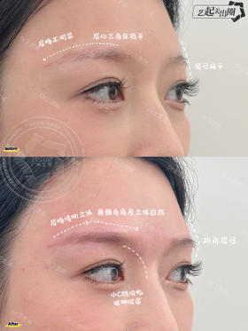 【王雯婷】-气质蝴蝶面眉弓打造