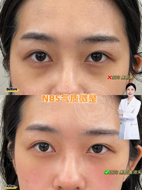 【王艳】院长-恋恋桃花眼