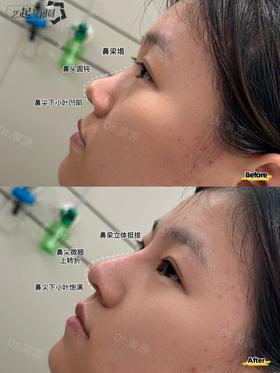 【黄源】主任-喜马拉雅中轴线