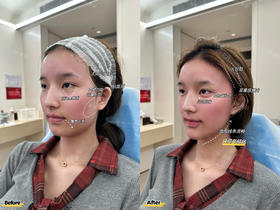 【黄源】主任-幼态脸打造