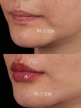 【王雯婷】院长口周年轻化