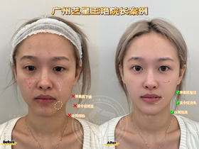 【王艳】院长-面部提升