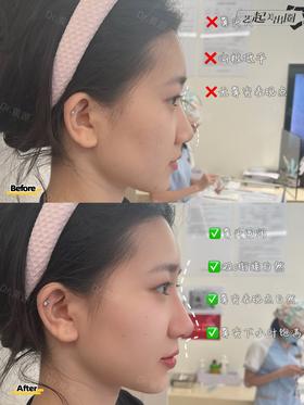 【黄源】主任-喜马拉雅中轴线