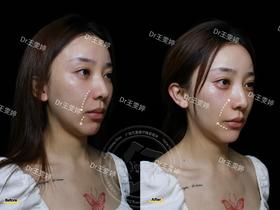 【王雯婷】院长口周年轻化＋恋恋桃花眼