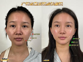 【王艳】院长-幼态脸综合打造