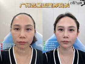 【王雯婷】院长-综合打造