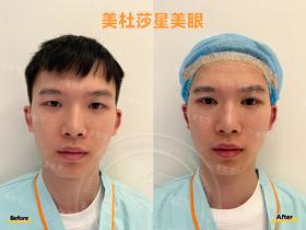 【曾繁茂】美杜莎星美眼