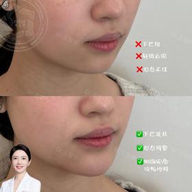 【王雯婷】赫本线重塑