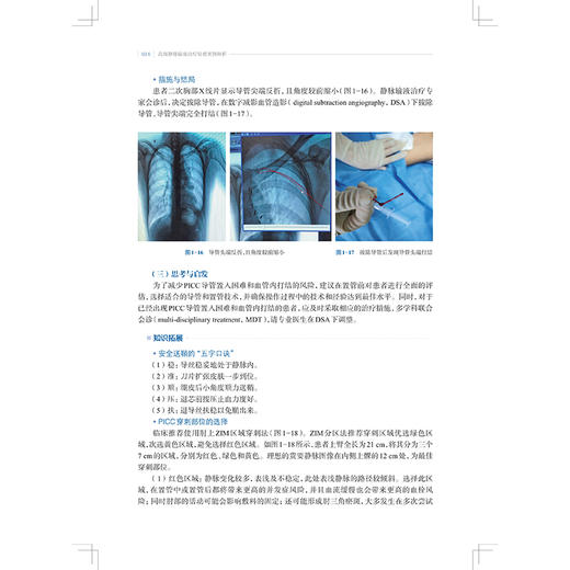 高级静脉输液治疗疑难案例解析 曹洁 陆小英 主编 可为护理人员处理高级静脉输液的各种复杂疑难问题提供参考 上海科学技术出版社 商品图4