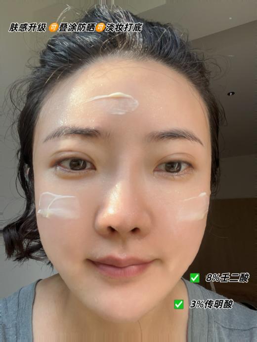 初尹8%壬二酸净颜精华20g 控油、祛痘、舒缓、敏感肌适用 商品图3